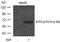Activating Transcription Factor 2 antibody, GTX50110, GeneTex, Western Blot image 