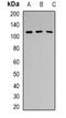 Pre-MRNA Processing Factor 6 antibody, orb339044, Biorbyt, Western Blot image 