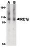 Endoplasmic Reticulum To Nucleus Signaling 1 antibody, LS-C19556, Lifespan Biosciences, Western Blot image 