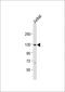 Sterol Regulatory Element Binding Transcription Factor 1 antibody, GTX81061, GeneTex, Western Blot image 