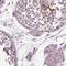 MUARP2 antibody, HPA066774, Atlas Antibodies, Immunohistochemistry paraffin image 