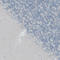 CF Transmembrane Conductance Regulator antibody, HPA021939, Atlas Antibodies, Immunohistochemistry paraffin image 