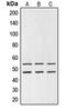 Glycogen Synthase Kinase 3 Alpha antibody, MBS821260, MyBioSource, Western Blot image 