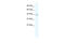 Gamma-Aminobutyric Acid Type A Receptor Alpha3 Subunit antibody, 28-228, ProSci, Western Blot image 