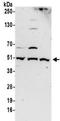 DNA Polymerase Delta 2, Accessory Subunit antibody, NBP2-32093, Novus Biologicals, Western Blot image 