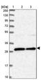 BCDIN3 Domain Containing RNA Methyltransferase antibody, PA5-58979, Invitrogen Antibodies, Western Blot image 