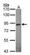 Serine/threonine-protein kinase DCLK2 antibody, PA5-21711, Invitrogen Antibodies, Western Blot image 