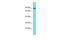 Mitogen-Activated Protein Kinase 8 Interacting Protein 2 antibody, PA5-70097, Invitrogen Antibodies, Western Blot image 