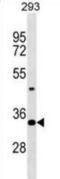 Homeobox D9 antibody, abx029794, Abbexa, Western Blot image 