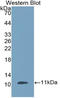 Defensin Beta 1 antibody, LS-C293658, Lifespan Biosciences, Western Blot image 