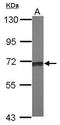 Transketolase Like 2 antibody, GTX118468, GeneTex, Western Blot image 