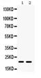 Glutathione Peroxidase 4 antibody, PA5-79321, Invitrogen Antibodies, Western Blot image 