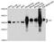 Thiosulfate Sulfurtransferase antibody, A10542, ABclonal Technology, Western Blot image 