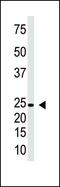 Interferon Lambda 1 antibody, PA5-11710, Invitrogen Antibodies, Western Blot image 