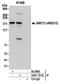 Lysine Demethylase 5D antibody, A301-751A, Bethyl Labs, Immunoprecipitation image 