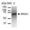 BR serine/threonine-protein kinase 1 antibody, SPC-686D-A633, StressMarq, Western Blot image 