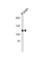 Calcium/Calmodulin Dependent Serine Protein Kinase antibody, abx034882, Abbexa, Western Blot image 