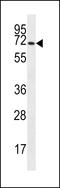 Solute Carrier Family 6 Member 14 antibody, 56-772, ProSci, Western Blot image 