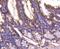 SMAD Family Member 4 antibody, NBP2-67372, Novus Biologicals, Immunohistochemistry paraffin image 