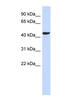 Sphingomyelin Synthase 2 antibody, NBP1-60005, Novus Biologicals, Western Blot image 