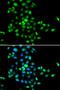 SBDS Ribosome Maturation Factor antibody, 19-912, ProSci, Immunofluorescence image 