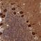 AlkB Homolog 1, Histone H2A Dioxygenase antibody, HPA044087, Atlas Antibodies, Immunohistochemistry paraffin image 