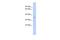 Tripartite Motif Containing 34 antibody, A12201, Boster Biological Technology, Western Blot image 