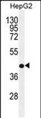 Retinol dehydrogenase 13 antibody, PA5-48326, Invitrogen Antibodies, Western Blot image 