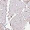 Myosin Light Chain 7 antibody, HPA013331, Atlas Antibodies, Immunohistochemistry frozen image 