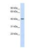 Carboxypeptidase B2 antibody, NBP1-57920, Novus Biologicals, Western Blot image 