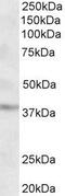 Growth Hormone Inducible Transmembrane Protein antibody, GTX88163, GeneTex, Western Blot image 