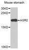 Anterior Gradient 2, Protein Disulphide Isomerase Family Member antibody, STJ22544, St John