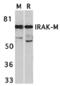 Interleukin 1 Receptor Associated Kinase 3 antibody, MBS150500, MyBioSource, Western Blot image 