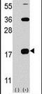 CD247 Molecule antibody, PA5-11452, Invitrogen Antibodies, Western Blot image 
