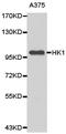 Hexokinase 1 antibody, TA326901, Origene, Western Blot image 