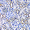 Megakaryocyte-Associated Tyrosine Kinase antibody, A6651, ABclonal Technology, Immunohistochemistry paraffin image 