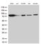 Ezrin antibody, LS-C791092, Lifespan Biosciences, Western Blot image 