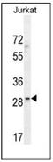 Leucine Rich Repeat Containing 25 antibody, AP52528PU-N, Origene, Western Blot image 