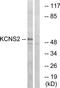 Potassium Voltage-Gated Channel Modifier Subfamily S Member 2 antibody, TA314138, Origene, Western Blot image 