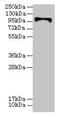 Hexokinase Domain Containing 1 antibody, CSB-PA647983LA01HU, Cusabio, Western Blot image 