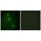 Activating Transcription Factor 1 antibody, A01600, Boster Biological Technology, Immunohistochemistry paraffin image 