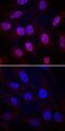 Ribosomal Protein S6 Kinase A5 antibody, MAB25181, R&D Systems, Immunohistochemistry paraffin image 