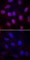 Ribosomal protein S6 kinase alpha-5 antibody, MAB25181, R&D Systems, Immunohistochemistry paraffin image 