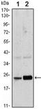 RAB10, Member RAS Oncogene Family antibody, ab104859, Abcam, Western Blot image 