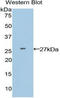 APC Regulator Of WNT Signaling Pathway antibody, LS-C303213, Lifespan Biosciences, Western Blot image 