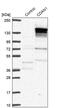 Codanin 1 antibody, PA5-58776, Invitrogen Antibodies, Western Blot image 