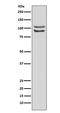 Fibroblast Growth Factor Receptor 4 antibody, M00769, Boster Biological Technology, Western Blot image 