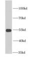 Glutamate Dehydrogenase 2 antibody, FNab03499, FineTest, Western Blot image 