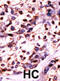 Uridine-Cytidine Kinase 2 antibody, abx033218, Abbexa, Immunohistochemistry frozen image 