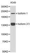 Tet Methylcytosine Dioxygenase 2 antibody, LS-C331509, Lifespan Biosciences, Western Blot image 